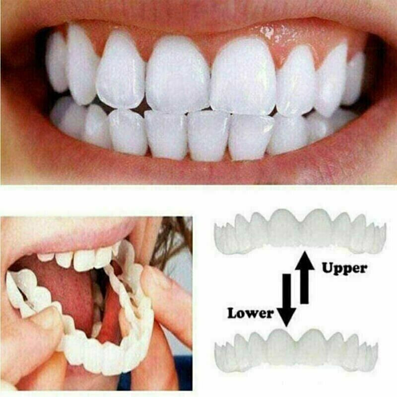 1 PAIR Snap on smile for upper and lower teeth